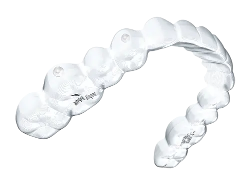 エンジェルアライナーの矯正措置