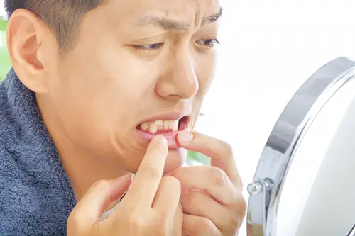 歯茎を気にする男性