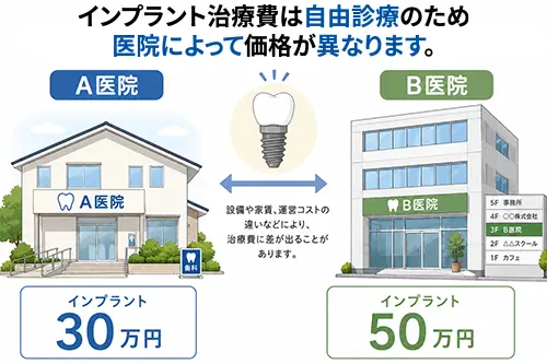 自由診療で価格が異なることを説明するイメージ