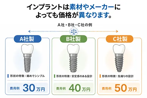 インプラントの素材やメーカーの違いを比較するイメージ