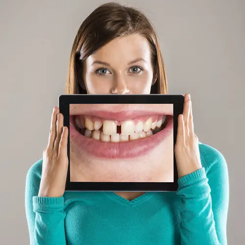歯の隙間の拡大写真を持った女性